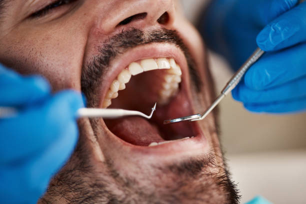Best Cosmetic Emergency Dentistry in Greenfield, MO