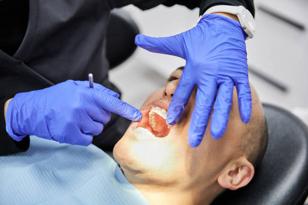 Best Emergency Dental Care for Broken or Chipped Teeth in Greenfield, MO