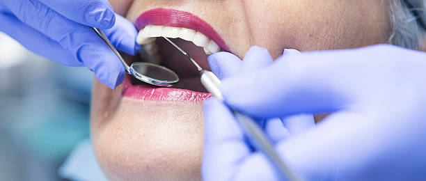 Best Emergency Denture Repair in Greenfield, MO